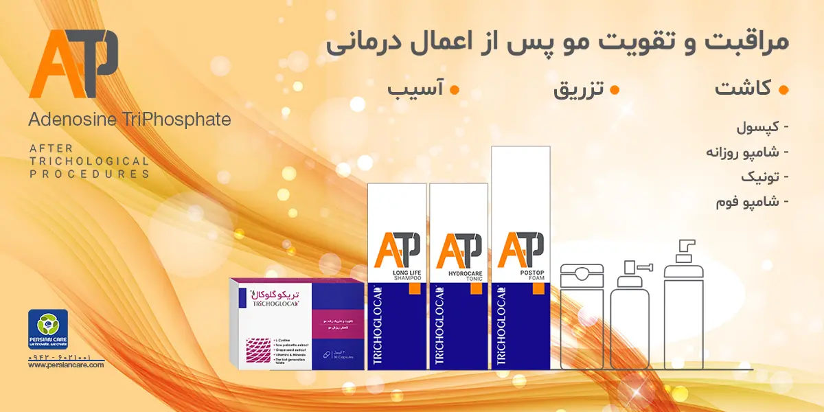 slider--1785824434-تریکو 1.webp